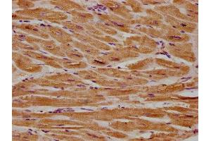 IHC image of ABIN7154398 diluted at 1:300 and staining in paraffin-embedded human heart tissue performed on a Leica BondTM system. (CSF3R 抗体  (AA 117-337))