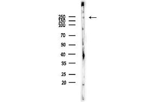 anti-phosphoinositide Kinase, FYVE Finger Containing (PIKFYVE) (N-Term) antibody
