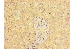 Immunohistochemistry of paraffin-embedded human liver tissue using ABIN7147018 at dilution of 1:100 (Cathepsin L 抗体  (AA 114-288))