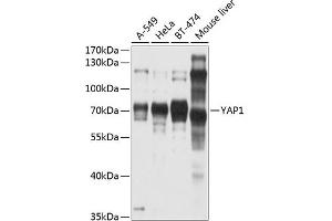 Western blot analysis of extracts of various cell lines, using Y antibody (ABIN6132788, ABIN6150316, ABIN6150321 and ABIN6215135) at 1:1000 dilution. (YAP1 抗体  (AA 155-504))