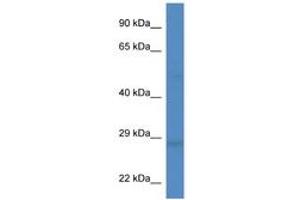 Image no. 1 for anti-Dickkopf 2 Homolog (DKK2) (AA 124-173) antibody (ABIN6749760) (DKK2 抗体  (AA 124-173))