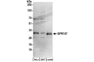 anti-G Protein-Coupled Receptor 157 (GPR175) (AA 285-335) antibody