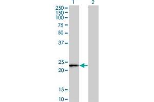 Western Blot analysis of FBXO36 expression in transfected 293T cell line by FBXO36 monoclonal antibody (M02), clone 3D3. (FBXO36 抗体  (AA 66-165))