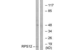 Western blot analysis of extracts from COLO cells, using RPS12 antibody. (RPS12 抗体  (C-Term))