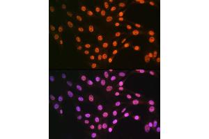 Immunofluorescence analysis of NIH-3T3 cells using TDP-43/TARDB Rabbit pAb (ABIN6128807, ABIN6148854, ABIN6148857 and ABIN6217391) at dilution of 1:100 (40x lens). (TARDBP 抗体  (AA 1-100))