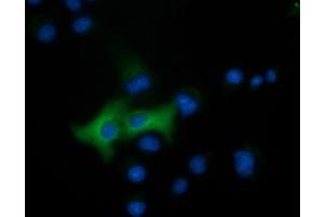 Anti-EPHX2 mouse monoclonal antibody (ABIN2452991) immunofluorescent staining of COS7 cells transiently transfected by pCMV6-ENTRY EPHX2 (RC202489). (EPHX2 抗体)
