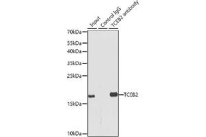 Immunoprecipitation (IP) image for anti-Transcription Elongation Factor B (SIII), Polypeptide 2 (18kDa, Elongin B) (TCEB2) (AA 1-118) antibody (ABIN6148934)