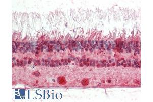 ABIN1590000 (5µg/ml) staining of paraffin embedded Human Retina. (CRX 抗体  (Internal Region))