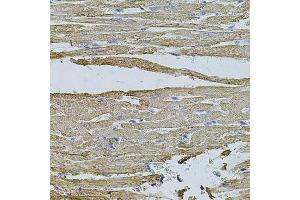 Immunohistochemistry (Paraffin-embedded Sections) (IHC (p)) image for anti-Hyaluronan-Mediated Motility Receptor (RHAMM) (HMMR) (AA 341-440) antibody (ABIN3016223)