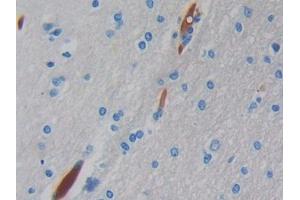 DAB staining on IHC-P; Samples: Human Brain Tissue (Hemoglobin, mu 抗体  (AA 13-141))