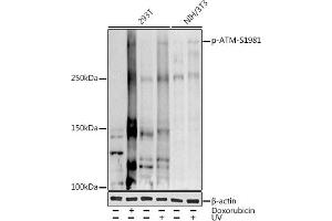 Western blot analysis of extracts of various cell lines, using (ABIN3019428, ABIN3019429, ABIN3019430 and ABIN6225361) at 1:1000 dilution. (ATM 抗体  (pSer1981))