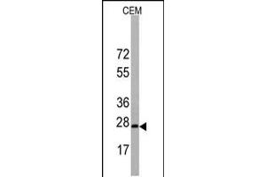 Western blot analysis of BarX1 Antibody in CEM cell line lysates (35ug/lane). (BARX1 抗体  (C-Term))