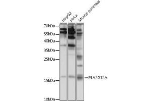 Western blot analysis of extracts of various cell lines, using PLG12A antibody (ABIN7269339) at 1:1000 dilution. (PLA2G12A 抗体  (AA 1-100))