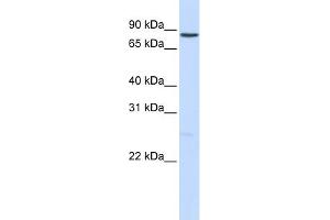 WB Suggested Anti-NOTCH1 Antibody Titration:  0. (Notch1 抗体  (Middle Region))