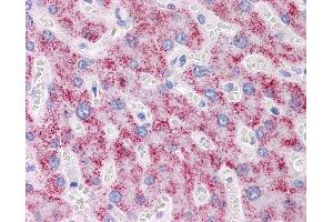 Anti-DAZ1 antibody IHC of human liver. (DAZ1 抗体  (AA 21-121))