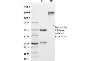 SDS-PAGE Analysis Purified N-Cadherin Mouse Monoclonal Antibody (CDH2/1573). (N-Cadherin 抗体  (Intracellular))