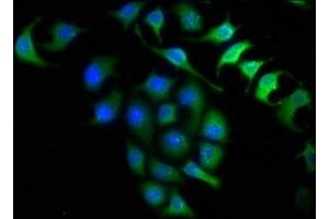 Immunofluorescence staining of A549 cells with ABIN7156215 at 1:150, counter-stained with DAPI. (INMT 抗体  (AA 1-263))