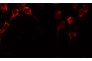 ABIN6268681 staining COLO205 by IF/ICC. (SIRT3 抗体  (C-Term))