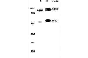 Formalin-fixed and paraffin embedded human gastric tissue labeled with Anti NRSF/REST Polyclonal Antibody,Unconjugated (ABIN747683) at 1:200 followed by conjugation to the secondary antibody and DAB staining. (REST 抗体  (AA 401-450))