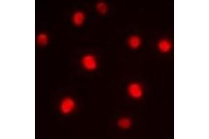 Immunofluorescent analysis of ZNF265 staining in HepG2 cells. (ZNF265 抗体)