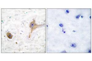 Immunohistochemistry (IHC) image for anti-GABA B Receptor (C-Term) antibody (ABIN1848554) (GABA B Receptor (C-Term) 抗体)