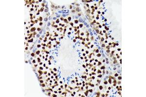 Immunohistochemistry of paraffin-embedded mouse testis using EWSR1 Rabbit mAb (ABIN7267053) at dilution of 1:100 (40x lens). (EWSR1 抗体)