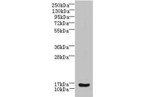 Western blot All lanes: ZNRD1 antibody at 14 μg/mL + Human high value serum Secondary Goat polyclonal to rabbit IgG at 1/10000 dilution Predicted band size: 14 kDa Observed band size: 14 kDa (ZNRD1 抗体  (AA 1-126))