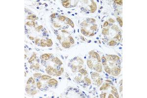 Immunohistochemistry of paraffin-embedded human stomach using ACP1 antibody (ABIN5975334) at dilution of 1/100 (40x lens). (ACP1 抗体)