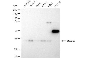 Western blotting analysis using Desmin antibody (ABIN7798314). (Recombinant Desmin 抗体)