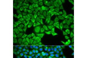 Immunofluorescence analysis of HeLa cells using SLC3A1 Polyclonal Antibody (SLC3A1 抗体)