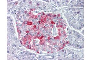 Immunohistochemistry (IHC) image for anti-Proprotein Convertase Subtilisin/kexin Type 1 (PCSK1) (AA 683-732) antibody (ABIN6748492)