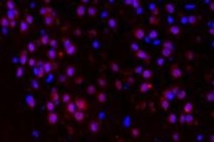 Immunofluorescent analysis of paraformaldehyde-fixed mouse brain substantia nigra using p38IP (ABIN7075954) at dilution of 1: 400 (Transcription Factor SPT20 Homolog (SUPT20H) 抗体)