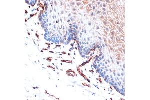 Immunohistochemistry of paraffin-embedded human esophageal using Cadherin-13 (CDH13) Rabbit mAb (ABIN7265996) at dilution of 1:100 (40x lens). (Cadherin 13 抗体)