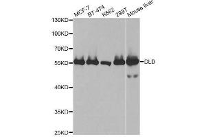 Western blot analysis of extracts of various cell lines, using DLD antibody. (DLD 抗体  (AA 36-300))
