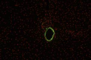 Immunohistochemistry staining (paraffin sections) of cytokeratin 19 in human liver using mouse monoclonal antibody BA-17 ((ABIN94288), diluted 1:100), detected with GAM IgG-Alexa Fluor488 (diluted 1:200, green), cell nuclei stained with PI (1 μg/mL, orange). (Cytokeratin 19 抗体)