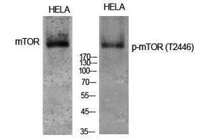 Western Blotting (WB) image for anti-Mechanistic Target of Rapamycin (serine/threonine Kinase) (mTOR) (pThr2446) antibody (ABIN3179552) (MTOR 抗体  (pThr2446))
