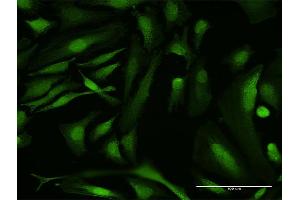 Immunofluorescence of purified MaxPab antibody to RBMY1A1 on HeLa cell. (RBMY1A1 抗体  (AA 1-356))