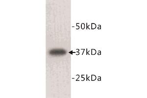 Western Blotting (WB) image for anti-Lactate Dehydrogenase A (LDHA) antibody (ABIN1854932) (Lactate Dehydrogenase A 抗体)