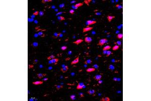 Immunofluorescence of paraffin embedded rat brain using rasgrf1 (ABIN7073422) at dilution of 1:2000 (400x lens) (Cdc25 抗体)