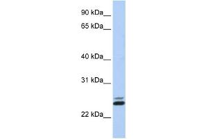 WB Suggested Anti-JAZF1 Antibody Titration:  0. (JAZF1 抗体  (N-Term))