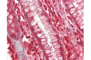 Human Colon: Formalin-Fixed, Paraffin-Embedded (FFPE). (MRPL19 抗体  (FITC))