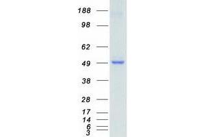 Western Blotting (WB) image for serine/threonine Kinase 32B (STK32B) protein (Myc-DYKDDDDK Tag) (ABIN2732873)