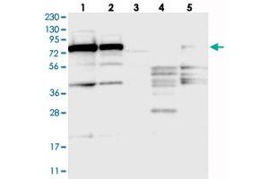 Western blot analysis of Lane 1: RT-4, Lane 2: U-251 MG, Lane 3: Human Plasma, Lane 4: Liver, Lane 5: Tonsil with SRP72 polyclonal antibody  at 1:250-1:500 dilution. (SRP72 抗体)