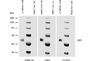 Western blotting analysis of human CD5 using mouse monoclonal antibodies MEM-32, CRIS1, and L17F12 on laurylmaltoside lysates of Jurkat cells and of K562 cells (negative control) under non-reducing conditions.