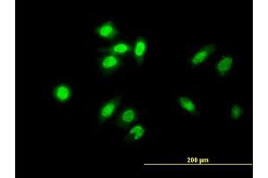 Immunofluorescence of monoclonal antibody to TESK2 on HeLa cell. (TESK2 抗体  (AA 405-542))