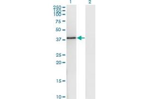 Western Blot analysis of DNAJB6 expression in transfected 293T cell line by DNAJB6 monoclonal antibody (M03), clone 1A5. (DNAJB6 抗体  (AA 72-172))