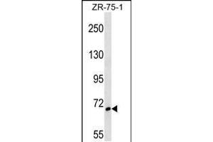 Western blot analysis in ZR-75-1 cell line lysates (35ug/lane). (SH3BP1 抗体  (AA 419-446))