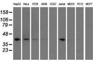 Western blot analysis of extracts (35 µg) from 9 different cell lines by using anti-HIBCH monoclonal antibody. (HIBCH 抗体)