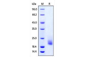 SDS-PAGE (SDS) image for T Cell Immunoreceptor with Ig and ITIM Domains (TIGIT) (AA 89-208) (Active) protein (His tag) (ABIN4949059)