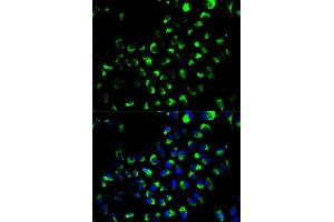 Immunofluorescence analysis of A549 cells using AK4 antibody. (AK4 抗体  (AA 1-223))